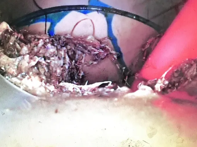 Monitor showing roots and debris caught inside the sewer pipe in Baulkham Hills