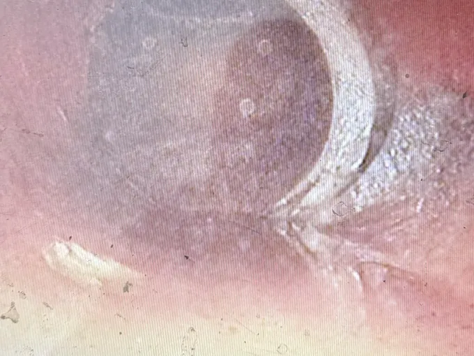 Monitor screen with a displaced joint inside the sewer pipe in Beverly Hills