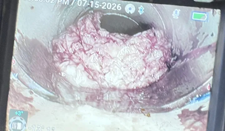 Mass of roots filling most of the pipe, seen on a drain camera in Liverpool